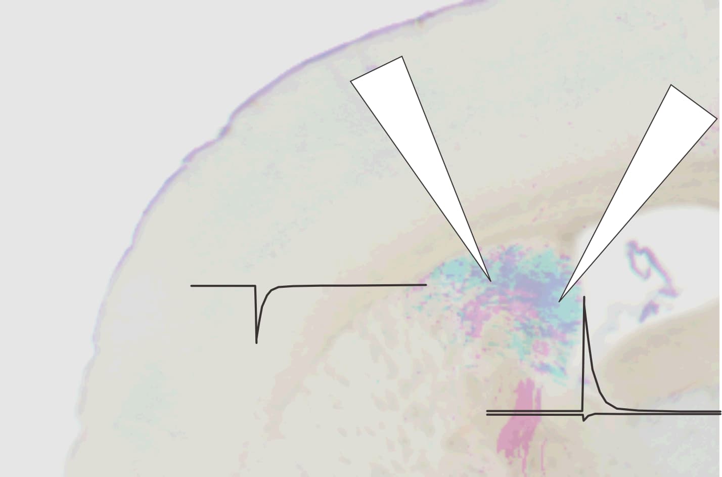 Microscopy and recording imagery representing in vitro physiology.